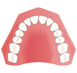 歯並び　上あごの模型 © koti