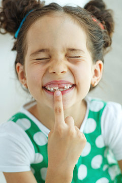 Little Girl With No Tooth. The Child Lost A Tooth. High Quality Photo.