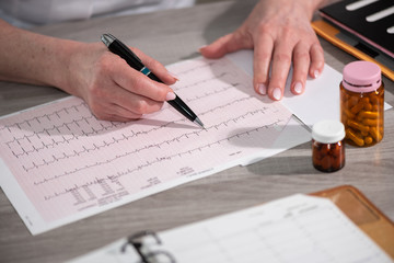 Female cardiologist examining an ecg graph