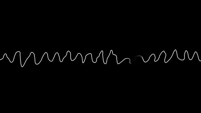 PNG Alpha.ECG looping.Vfib.Heart rate Ventricular fibrillation.Abnormal heart rhythm.Cardiogram monitor.Technological HUD for medicine and science,Medical Institute students.Template.Type 6