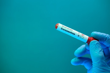 Fototapeta premium laboratory technician hand holding corona blood test tube 