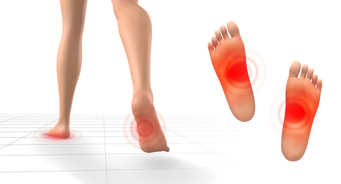 vector set of legs with red patches of pain on a white background