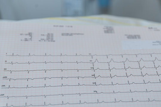 Langzeit-EKG zur Herzuntersuchung