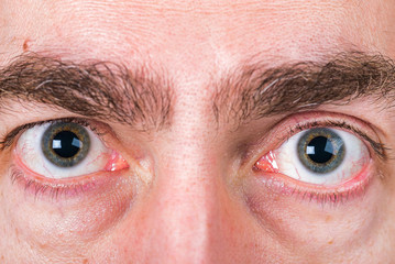 Fototapeta premium Big eyes of man with light skin and strong eyebrow and circles under eyes