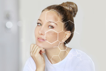 Dark spots, freckles,hyperpigmentation(melasma or chloasma),concept- skin lightening, skin...