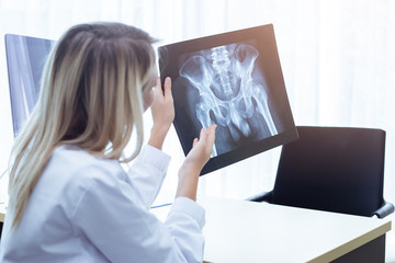 woman doctor showing x-ray film of body patient patient at hospital, health care concept.