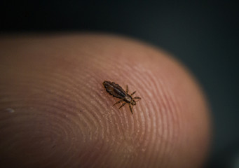 A Head Louse!
Adult lice are small flattened & entirely wingless. 
Abdomen is composed of seven visible segments, 6 legs, grayish white & about the size of a sesame seed. 
