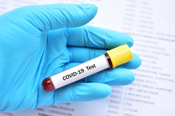 Test tube with blood sample for COVID-19 test, novel coronavirus pandemic disease in 2020