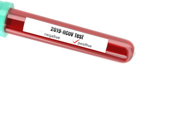 3D rendering of a test tube for covid 19 blood test with selective focus technique