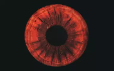 Foto auf Acrylglas red human iris © Lorant