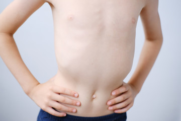 Fototapeta na wymiar kid, a boy of primary school age with a naked torso, slender structure, ribs, belly, the concept of children's health, happy childhood