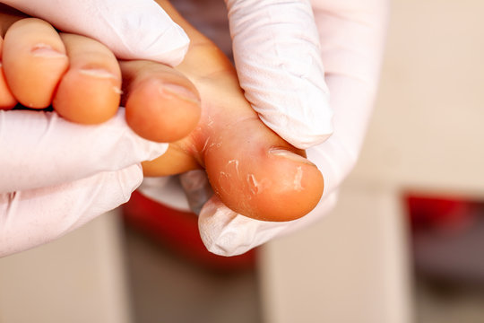 Doctor hand examining an little girl's foot