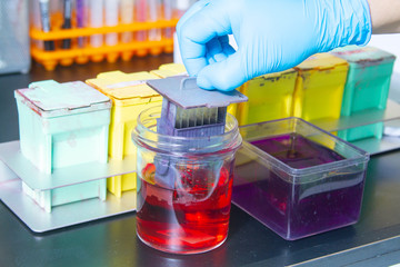 Histology test lab in hospital. Hands in gloves, tech loads slide glasses with patient biopsy sections. Automatic staining of lung tissue. Anatomic pathology, histopathology of viral pneumonia biopsy.