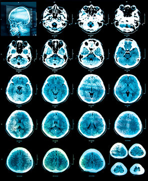 magnetic resonance color image (MRI) of the brain.