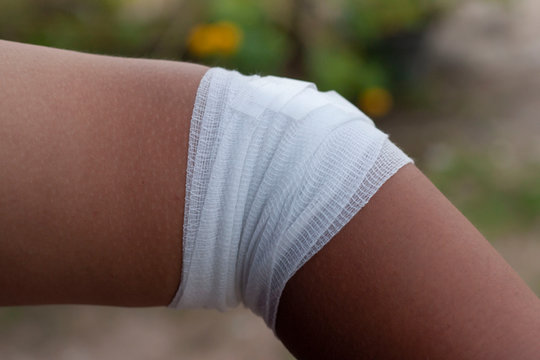 An Elbow Wrapped In Medical Gauze Due To The Wounded Injury.