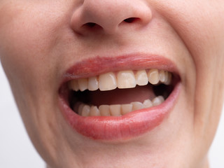 Middle aged woman laughs on white background showing perfect white teeth