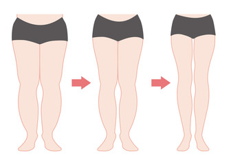 ダイエットの経過　脚やせ　カラー