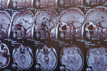 MRI scan of human head, closeup
