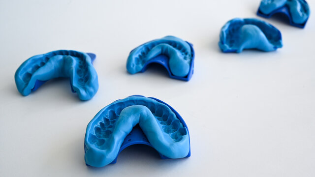 Dental Bissnahme, Abdruck, Abformung,  Impression von einem Oberkiefer und Unterkiefer in der Zahntechnik. 