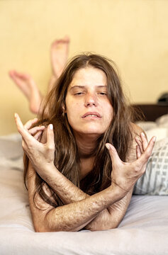 Portrait, hands and arms and of a Woman with heavy Cuts and scars of self-mutilation, self-abusing, Borderline personality disorder,