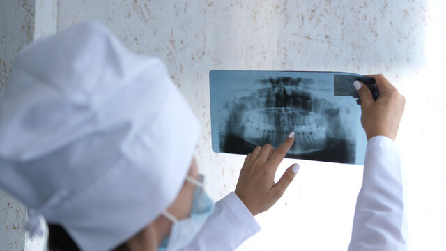 Closeup of dentist looking at dental x-ray plate.