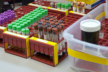 Vials Ready For Lab Testing
