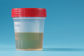 A container for biomaterials with a urine analysis and a red lid on a blue background.