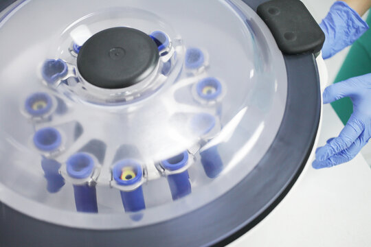 Laboratory medical centrifuge for the separation of blood components