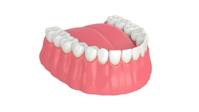Abnormal teeth position. Orthodontic treatment concept. 