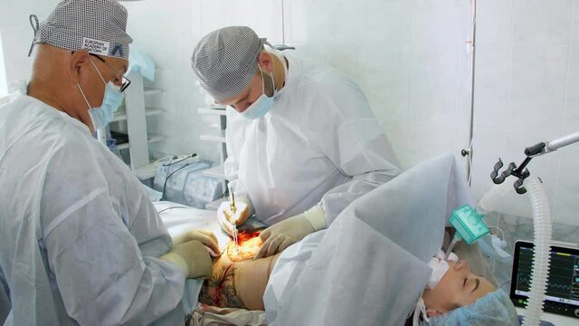 surgeon cuts out from patient a part of abdominal skin surface with a dense fat layer. surgery, abdominal liposuction in operating room, in hospital