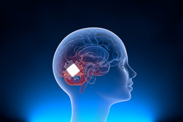 Neuralink surgically implant some computer components onto the surface of your brain to control equipments and improve the memory with neural link. 