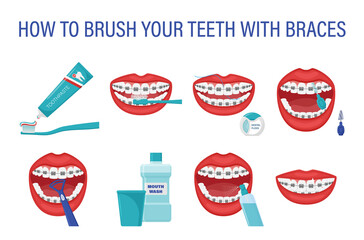 Infographic how to brush your teeth with braces. Step-by-step instructions. Oral hygiene. Healthy lifestyle and dental care. Clean white teeth. Prevention of caries. Isolated flat vector illustration.
