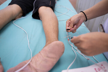 Traditional Chinese medicine is treating patients with leg acupuncture methods