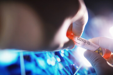 Test tube with patient blood for testing. Analysis for the virus. Coronavirus pandemic laboratory studies. Vaccine development.