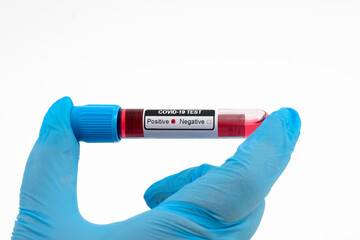 Test Coronavirus - positive result in the hand of a blue medical glove.