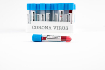 Blood test samples for presence of coronavirus (COVID-19) tube containing a blood sample that has tested positive for coronavirus.