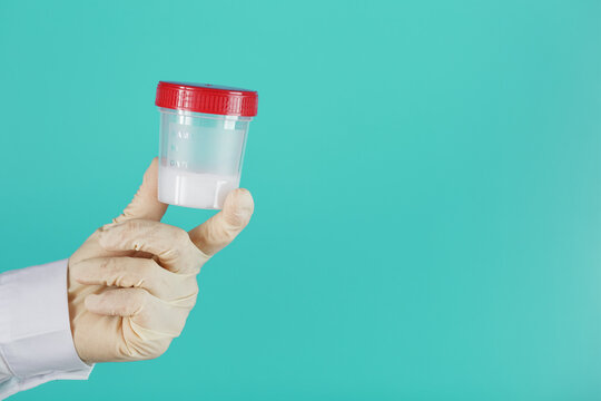 Semen in a jar for analysis in the doctor's hand on a blue background.