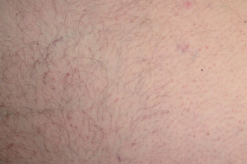 Close-up human skin with hair in detail. Man's hairy leg