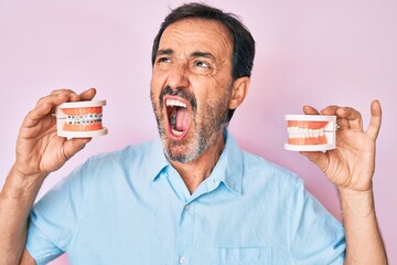 Middle age hispanic man holding orthodontic angry and mad screaming frustrated and furious,...