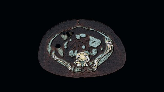 Bulk multicolored MRI of the abdominal cavity, gastrointestinal tract, bladder