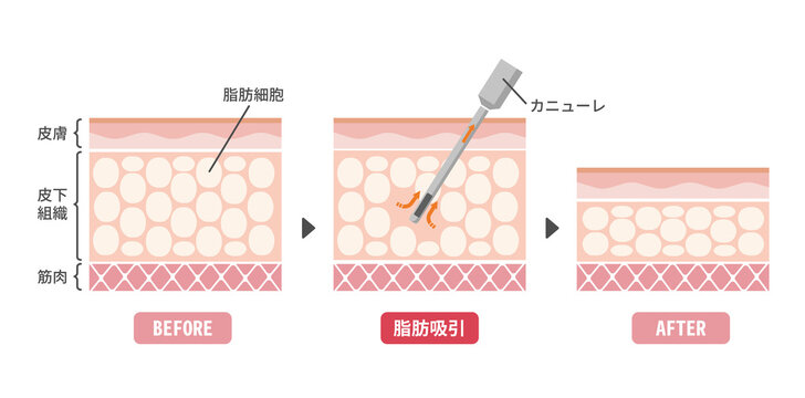 あぶない刑事 のストック写真 ロイヤリティフリーの画像 ベクター イラスト Adobe Stock あぶない刑事 のストック写真 ロイヤリティフリーの画像 ベクター イラスト Adobe Stock