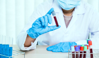 doctor's hand holding a sample blood tube for analysis and test virus disease in the laboratory,...