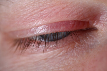Obraz premium Male eye with blue pupil and eyelashes close up. Laser correction to improve vision.