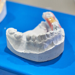 Fototapeta na wymiar Model of the human jaw. The cast of the human jaw. Dental equipment.