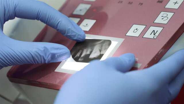 Dentist analyzing the x-ray image. Special device for taking picture of tooth. Professional work of the dentist and the image of damaged teeth. Examination of the image and condition of the teeth.
