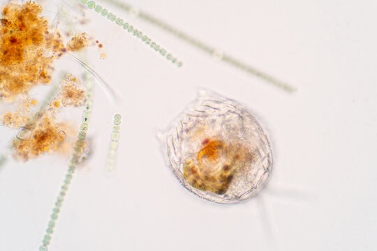 Rotifera, commonly called wheel animals under the microscopic view.