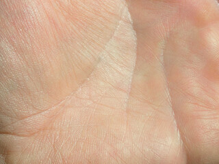 Dry man hand skin from close up