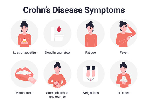 Crohn's disease is a type of inflammatory bowel disease. Crohn syndrome infographics. Flat vector cartoon illustration.