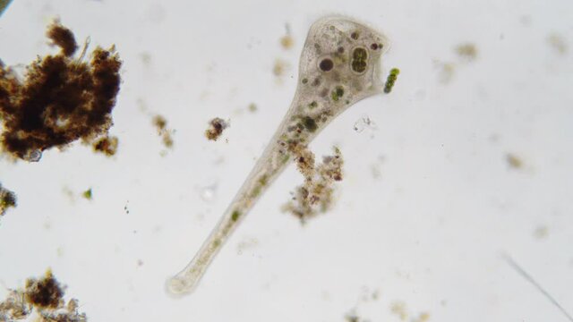 Stentor, genus of trumpet-shaped, contractile, uniformly ciliated protozoans.They are found in fresh water, either free-swimming or attached to submerged vegetation.