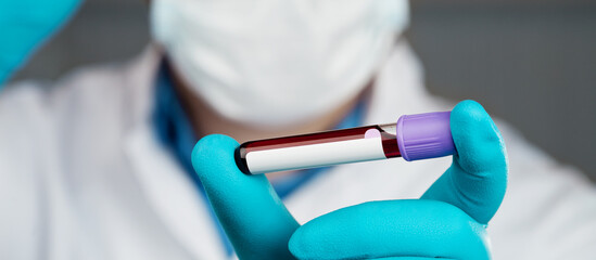 Coronavirus 2019-nCoV Blood Sample.